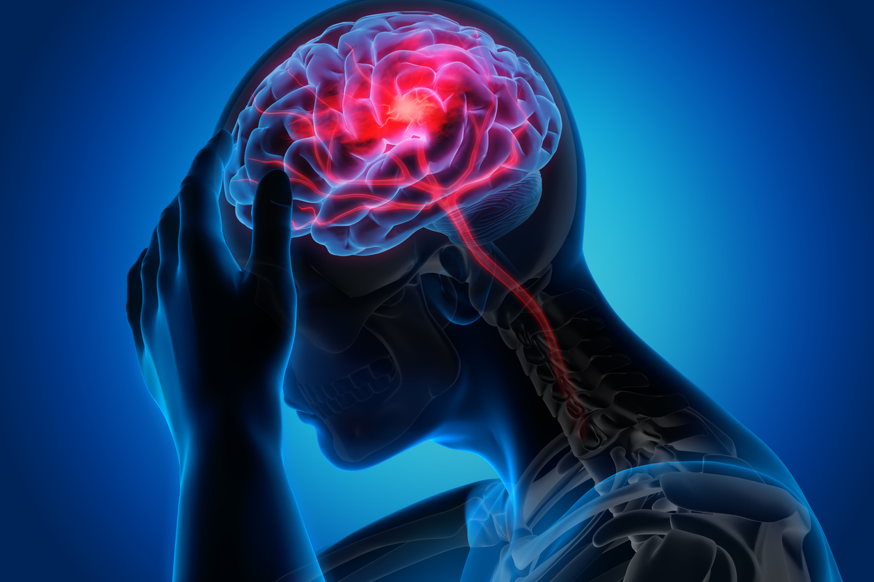 Quais são as principais causas do Acidente Vascular Cerebral